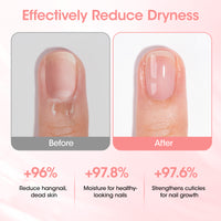 Gellen Cuticle Oil, Nourishing Nail Growth Oil Pen | Rich with Jojoba Oil & VE Soften Cuticles Strengthen Healthier-Looking Nails, Brush Applicator, Pro Care for Nails & Dry Hands, Strawberry Scent