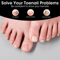Gellen Soft Gel Toenail Tips, 12 Sizes Full Cover Press On Toenails, 300pcs Matte Short Square Fake Toe Nails Easy Handle for Fast Pedicure