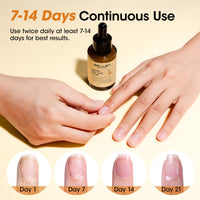 Gellen 30ml Ginger Nail Growth Serum for Nail Strengthener and Growth, Nail Repair Treatment for Weak Brittle Splitting Damaged Nails, Hydrated & Nourished Nail Care Solution