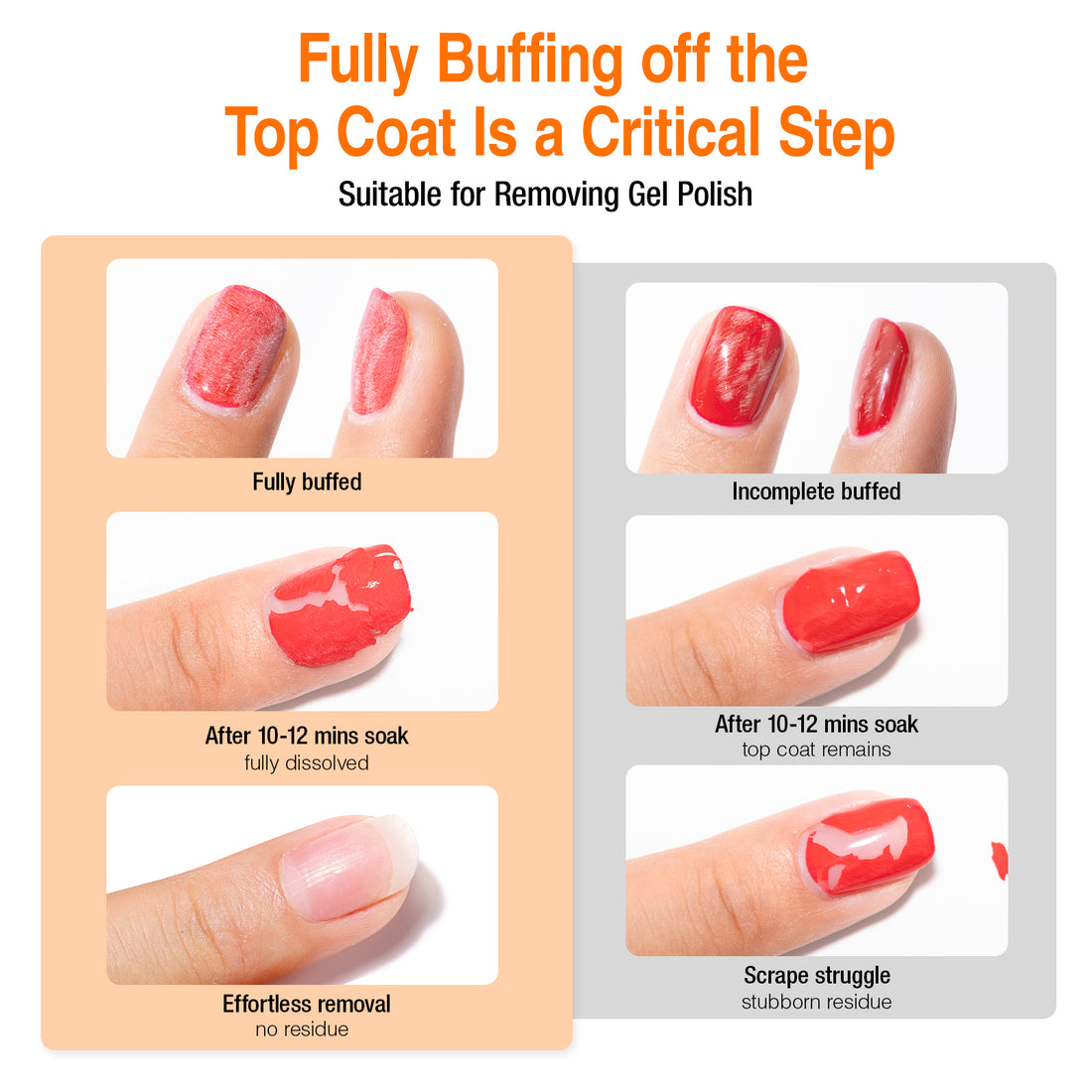 Candy Lover Gel Polish Remover, 200pcs Acetone-Free Gel Nail Polish Remover Wipes with Nail File and Cuticle Pusher, Professional Individually Wrapped Nail Polish Remover Pads