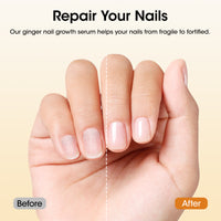 Gellen 30ml Ginger Nail Growth Serum for Nail Strengthener and Growth, Nail Repair Treatment for Weak Brittle Splitting Damaged Nails, Hydrated & Nourished Nail Care Solution