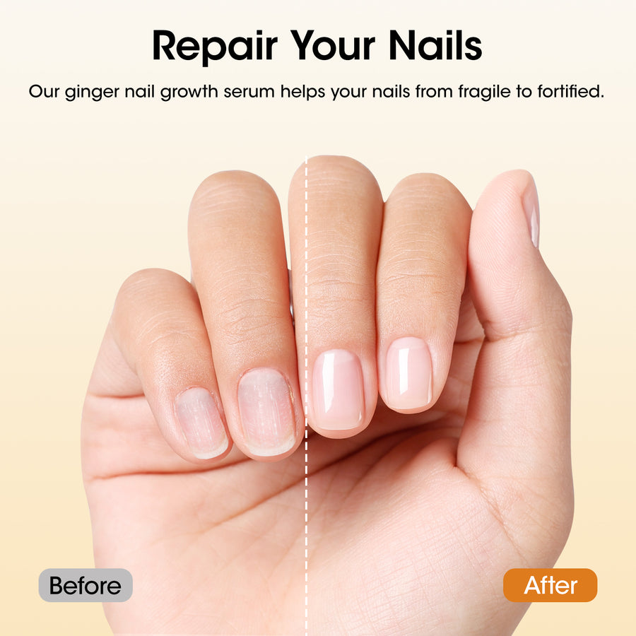 Gellen 30ml Ginger Nail Growth Serum for Nail Strengthener and Growth, Nail Repair Treatment for Weak Brittle Splitting Damaged Nails, Hydrated & Nourished Nail Care Solution