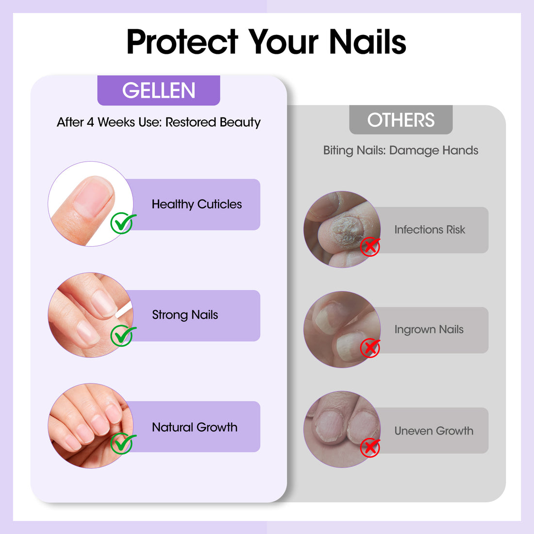 Gellen Nail Biting Treatment for Kids & Adults, Roll-On Stop Thumb Sucking Deterrent, Nail Biting Prevention, Quick Dry & Water-Resistant Anti Nail Biting Polish, Stop Nail Biting 10ml